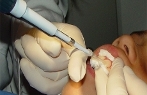 Imagem de tratamento dentrio.